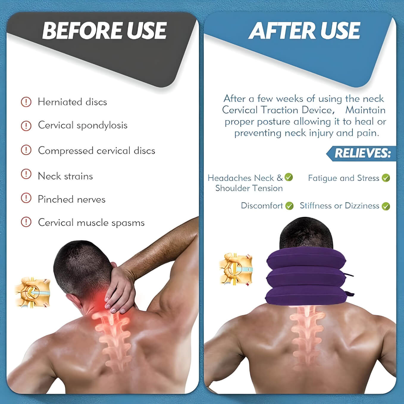 before-and-after-use-of-cervical-traction-device
